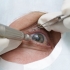 Ophthalmology